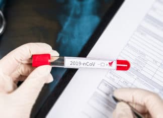 Corona-Test